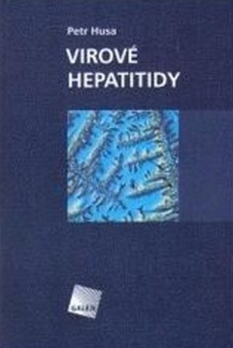 Virové hepatitidy