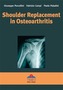 Shoulder Replacement in Osteoarthritis