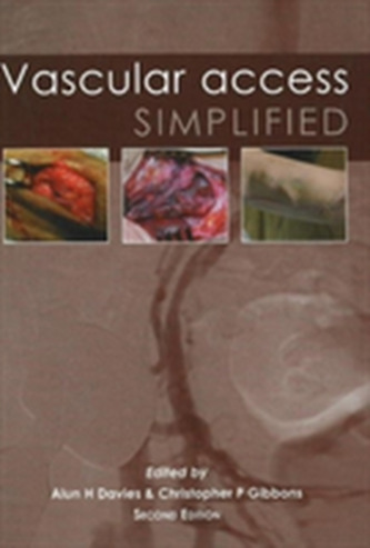 Vascular Access Simplified
