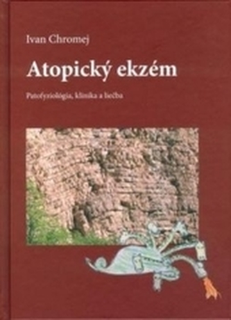 Atopický ekzém