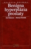 Benígna hyperplázia prostaty