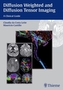 Diffusion Weighted and Diffusion Tensor Imaging