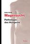 Magersucht