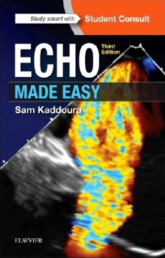 Echo Made Easy