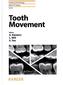 Tooth Movement