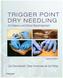 Trigger Point Dry Needling
