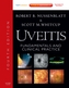 Uveitis