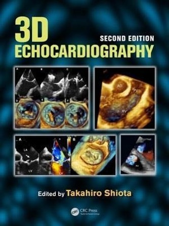 3D Echocardiography, Second Edition
