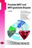 Prostata-MRT und MRT-gestützte Biopsie